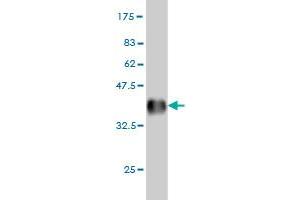 Western Blotting (WB) image for anti-A Kinase (PRKA) Anchor Protein 10 (AKAP10) (AA 1-100) antibody (ABIN564879)