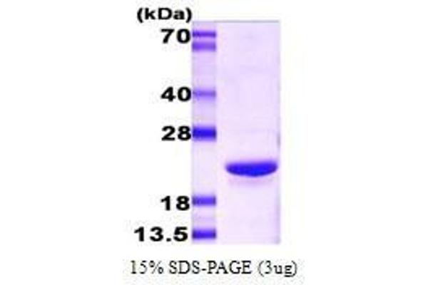 CRYAB Protein (AA 1-175)