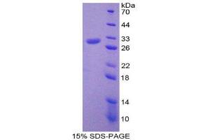 SDS-PAGE (SDS) image for Programmed Cell Death 6 Interacting Protein (PDCD6IP) (AA 1-239) protein (His tag) (ABIN1879394) (ALIX Protein (AA 1-239) (His tag))