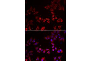 Immunofluorescence analysis of A549 cells using LIMS1 antibody. (LIMS1 抗体)