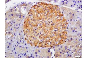 Immunohistochemistry (Paraffin-embedded Sections) (IHC (p)) image for anti-Glucagon-Like Peptide 1 Receptor (GLP1R) (AA 101-200) antibody (ABIN731333)