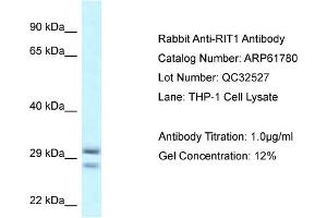Western Blotting (WB) image for anti-Ras-Like Without CAAX 1 (RIT1) (Middle Region) antibody (ABIN786493) (RIT1 抗体  (Middle Region))