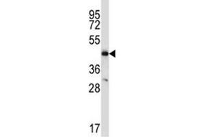 CCR9 antibody western blot analysis in MDA-MB435 lysate (CCR9 抗体  (AA 306-334))