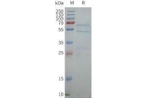 Human A-Nanodisc, Flag Tag on SDS-PAGE (ABCG1 蛋白)