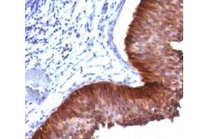 Western blot testing of human samples using Cytokeratin 17 antibody (E3). (KRT17 抗体)