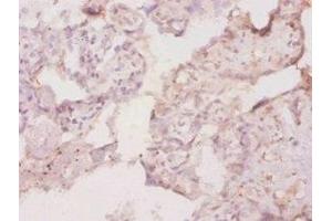 Immunohistochemistry of paraffin-embedded human placenta tissue using ABIN7177414 at dilution of 1:20 (M-CSF/CSF1 抗体  (AA 33-262))