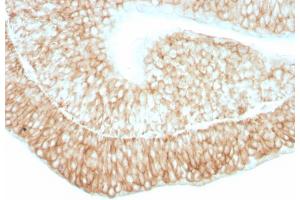 Formalin-fixed, paraffin-embedded human bladder stained with CD59 Mouse Monoclonal Antibody (193-27). (CD59 抗体)