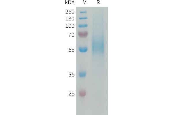 Macrophage Scavenger Receptor 1 Protein (MSR1) (AA 77-451) (His tag)
