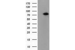 Western Blotting (WB) image for anti-Pseudouridylate Synthase 7 Homolog (PUS7) antibody (ABIN1500516) (PUS7 抗体)