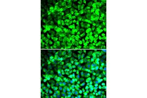 Immunofluorescence analysis of U2OS cells using EIF5 antibody. (EIF5 抗体)