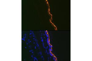 Immunofluorescence analysis of Mouse tail and ear using Cytokeratin 10 Rabbit mAb (ABIN1679404, ABIN3019133, ABIN3019134 and ABIN7101721) at dilution of 1:100 (40x lens). (Keratin 10 抗体)