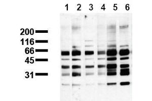 Western Blotting (WB) image for anti-Phosphoserine (phosphorylated) antibody (ABIN126865) (Phosphoserine 抗体  (phosphorylated))