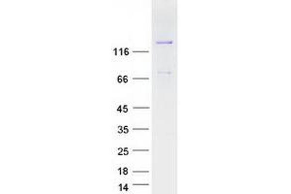 MAGI3 Protein (Transcript Variant 2) (Myc-DYKDDDDK Tag)