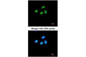 ICC/IF Image Immunofluorescence analysis of paraformaldehyde-fixed HeLa, using ATRX, antibody at 1:200 dilution. (ATRX 抗体  (C-Term))