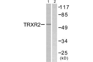 Western blot analysis of extracts from HT29 cells, using TRXR2 antibody. (TXNRD2 抗体  (C-Term))