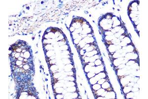 Immunohistochemistry of paraffin-embedded human colon using PBR/TSPORabbit mAb (ABIN1679051, ABIN3019258, ABIN3019259 and ABIN7101738) at dilution of 1:100 (40x lens). (TSPO 抗体)