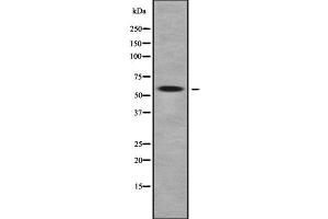 Western blot analysis of MOT9 using COLO205 whole cell lysates (SLC16A9 抗体  (Internal Region))