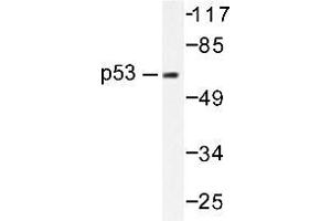 Western blot (WB) analysis of p53 antibody in extracts from HT-29 cells. (p53 抗体)