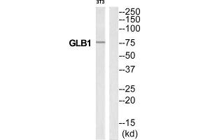 Western Blotting (WB) image for anti-Galactosidase, beta 1 (GLB1) (Internal Region) antibody (ABIN1850915) (GLB1 抗体  (Internal Region))