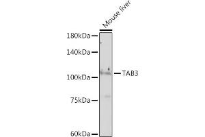 Western blot analysis of extracts of Mouse liver, using T antibody (ABIN7270793) at 1:1000 dilution. (TAB3 抗体)