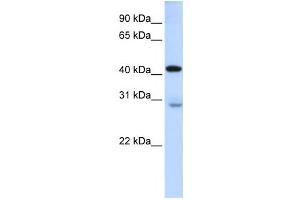 Western Blotting (WB) image for anti-GRAM Domain Containing 2 (GRAMD2) antibody (ABIN2458873) (GRAMD2 抗体)