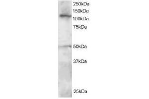 Image no. 1 for anti-Helicase-Like Transcription Factor (HLTF) (C-Term) antibody (ABIN374218) (HLTF 抗体  (C-Term))