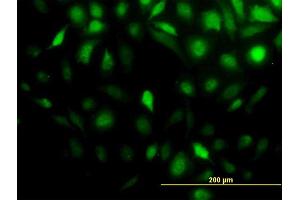 Immunofluorescence (IF) image for anti-Stress-Induced-phosphoprotein 1 (STIP1) (AA 1-543) antibody (ABIN564756)