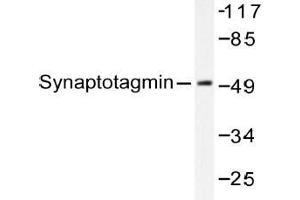 Western blot (WB) analysis of Synaptotagmin antibody in extracts from 293 cells Forskolin 40nM 30' or 293 cells Sorbitol 0. (SYT1 抗体)