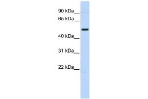 TRIM55 antibody used at 1 ug/ml to detect target protein. (TRIM55 抗体  (N-Term))