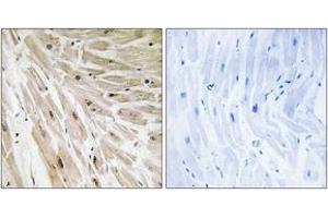 Immunohistochemistry (IHC) image for anti-Ribosomal Protein L22 (RPL22) (AA 51-100) antibody (ABIN2890073) (RPL22 抗体  (AA 51-100))