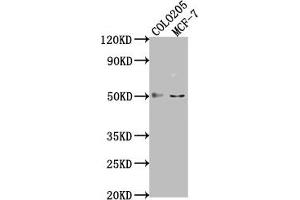 Western Blot Positive WB detected in: COLO205 whole cell lysate, MCF-7 whole cell lysate All lanes: LRAT antibody at 1:2000 Secondary Goat polyclonal to rabbit IgG at 1/50000 dilution Predicted band size: 26 kDa Observed band size: 50 kDa (LRAT 抗体  (AA 24-182))