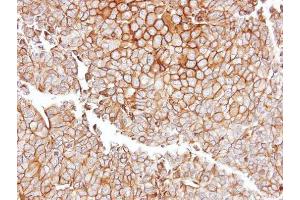 IHC-P Image Immunohistochemical analysis of paraffin-embedded PC13 xenograft, using GGT1, antibody at 1:100 dilution. (GGT1 抗体)