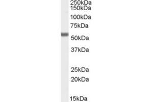 Western Blotting (WB) image for anti-Forkhead Box C1 (FOXC1) (C-Term) antibody (ABIN2465707) (FOXC1 抗体  (C-Term))