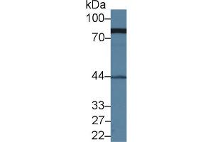 Western blot analysis of Human Serum, using Human MRE11A Antibody (1 µg/ml) and HRP-conjugated Goat Anti-Rabbit antibody ( (Mre11 抗体  (AA 375-609))