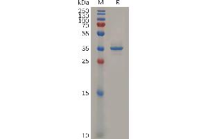 Human Protein, hFc Tag on SDS-PAGE under reducing condition. (Glypican 3 Protein (GPC3) (Fc Tag))