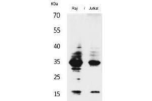 Western Blot analysis of Raji, Jurkat cells using IL-4 Polyclonal Antibody. (IL-4 抗体  (Internal Region))