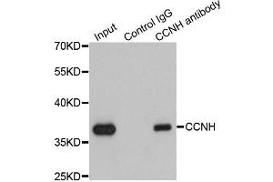 Immunoprecipitation analysis of 200 μg extracts of K562 cells using 1 μg CCNH antibody (ABIN5970383). (Cyclin H 抗体)
