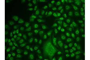 Immunofluorescence analysis of U2OS cells using TFPT antibody. (TFPT 抗体)