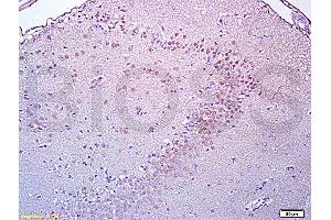 Formalin-fixed and paraffin embedded rat brain tissue labeled with Anti-Brdu Polyclonal Antibody, Unconjugated (ABIN729808) at 1:200, followed by conjugation to the secondary antibody and DAB staining (BrdU 抗体)