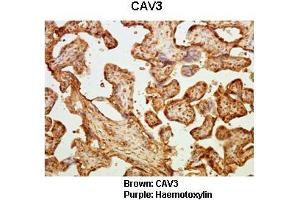 Sample Type :  Human placental tissue   Primary Antibody Dilution :   1:50  Secondary Antibody :  Goat anti rabbit-HRP   Secondary Antibody Dilution :   1:10,000  Color/Signal Descriptions :  Brown: CAV3 Purple: Haemotoxylin  Gene Name :  CAV3  Submitted by :  Dr. (Caveolin 3 抗体  (N-Term))
