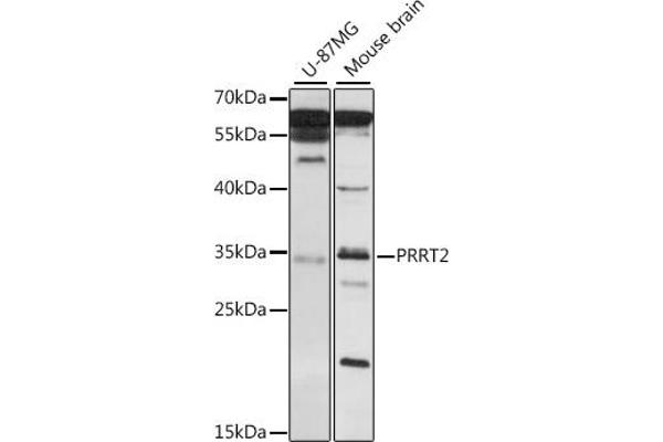 PRRT2 抗体  (AA 20-130)