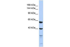 Western Blotting (WB) image for anti-Testis Expressed 11 (TEX11) (C-Term) antibody (ABIN2786547) (TEX11 抗体  (C-Term))