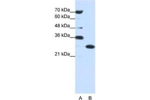 Western Blotting (WB) image for anti-Acidic (Leucine-Rich) Nuclear phosphoprotein 32 Family, Member A (ANP32A) antibody (ABIN2462045) (PHAP1 抗体)