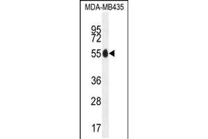 Western blot analysis in MDA-MB435 cell line lysates (35ug/lane). (PAX1 抗体  (N-Term))
