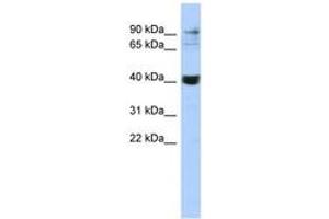 Image no. 1 for anti-Matrix Metallopeptidase 3 (Stromelysin 1, Progelatinase) (MMP3) (C-Term) antibody (ABIN6743087) (MMP3 抗体  (C-Term))