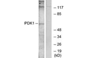 Western Blotting (WB) image for anti-3-phosphoinositide Dependent Protein Kinase-1 (PDPK1) (AA 210-259) antibody (ABIN2889054) (PDPK1 抗体  (AA 210-259))