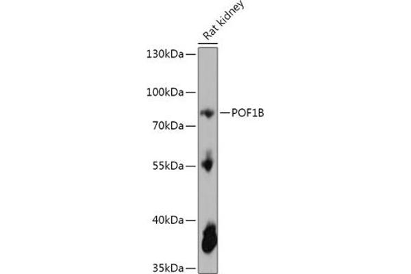 POF1B 抗体  (AA 330-560)