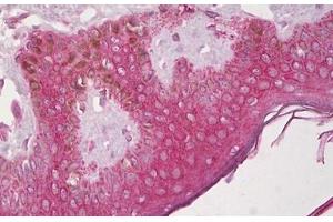 Anti-CXCR4 antibody IHC staining of human skin, epidermis. (CXCR4 抗体  (N-Term))