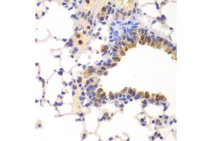 Immunohistochemistry of paraffin-embedded mouse lung using NFKB1 antibody at dilution of 1:200 (400x lens). (NFKB1 抗体)