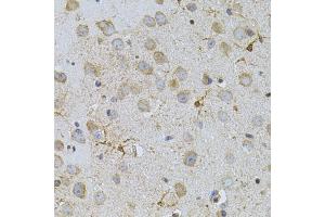 Immunohistochemistry of paraffin-embedded mouse brain using NAT8 antibody. (NAT8 抗体)